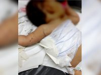 justica-mantem-prisao-de-mae-e-avo-de-bebe-que-deu-entrada-em-hospital-com-queimaduras-e-ferimentos