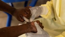 africa-declara-emergencia-em-saude-publica-por-epidemia-de-mpox