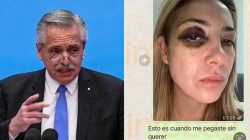 alberto-fernandez-e-formalmente-acusado-por-lesoes-graves,-ameacas-e-abuso-de-poder-contra-a-ex-mulher