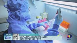 santa-catarina-tem-10-casos-confirmados-de-mpox