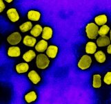 mpox:-restricoes-de-viagens-teriam-‘impacto-desnecessario’-nas-economias,-diz-oms