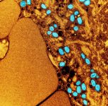 mpox:-saiba-quais-sao-os-sintomas-e-formas-de-transmissao-da-doenca