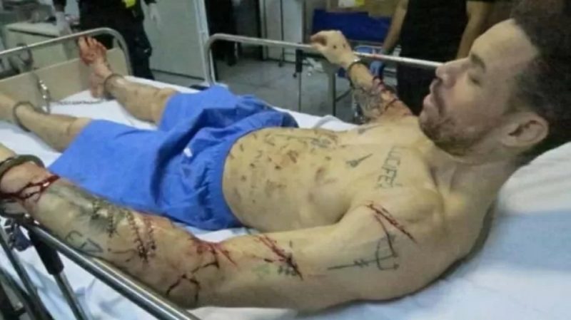 Marcos Paulo da Silva, o Lúcifer, deitado em uma maca; sem camisa, com tatuagens e os braços com cortes profundos